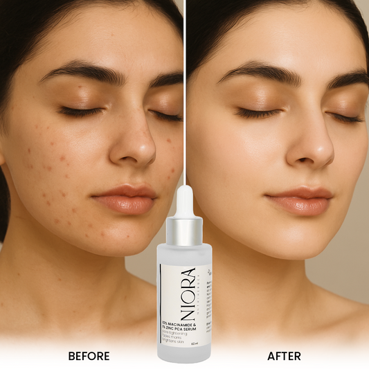 NIORA SERUM | 60 ml - 10% Niacinamide & 1% Zinc PCA