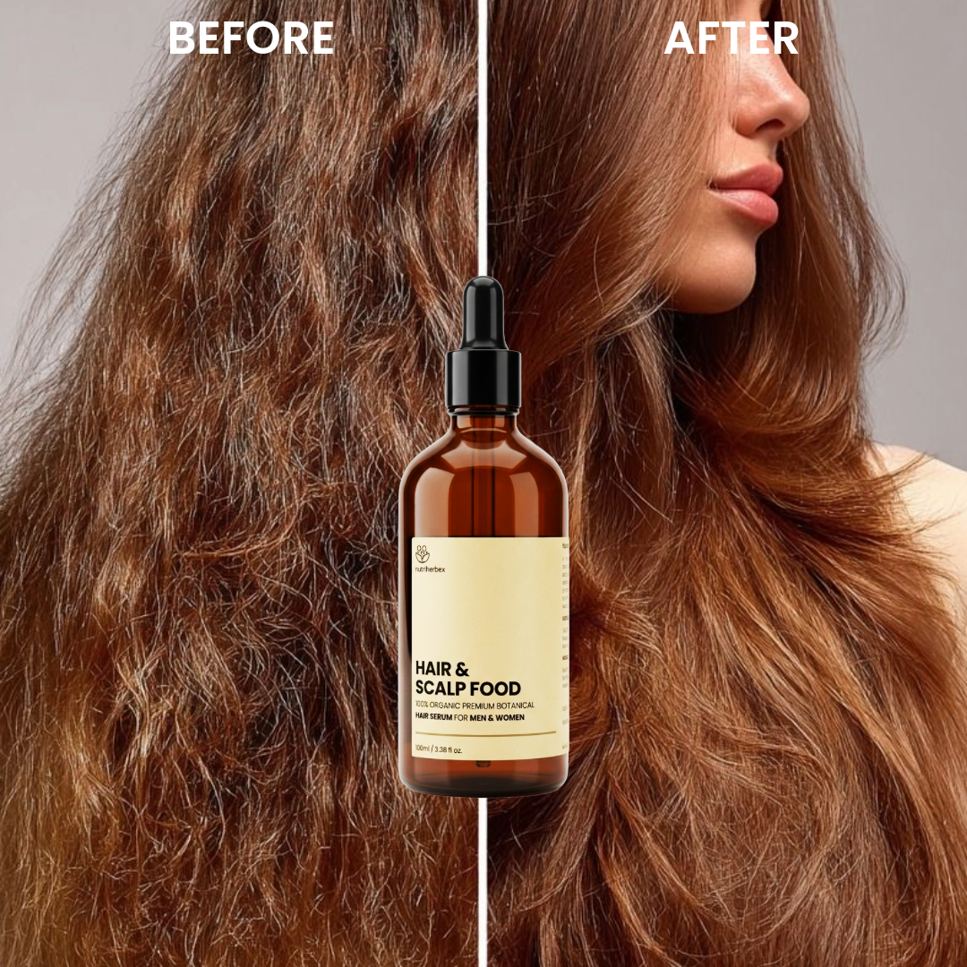 HAIR & SCALP FOOD | Hair Serum for Men & Women